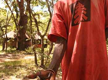 Wasa Lodge: Angestellter nach erfolgreicher Schlangenjagd